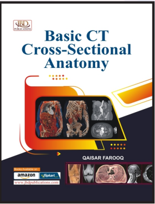 Basic CT Cross Sectional Anatomy (Coloured)